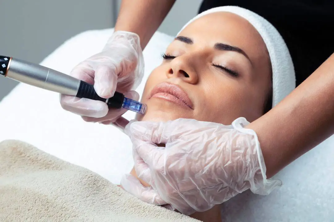 Μεσοθεραπεία Dermapen